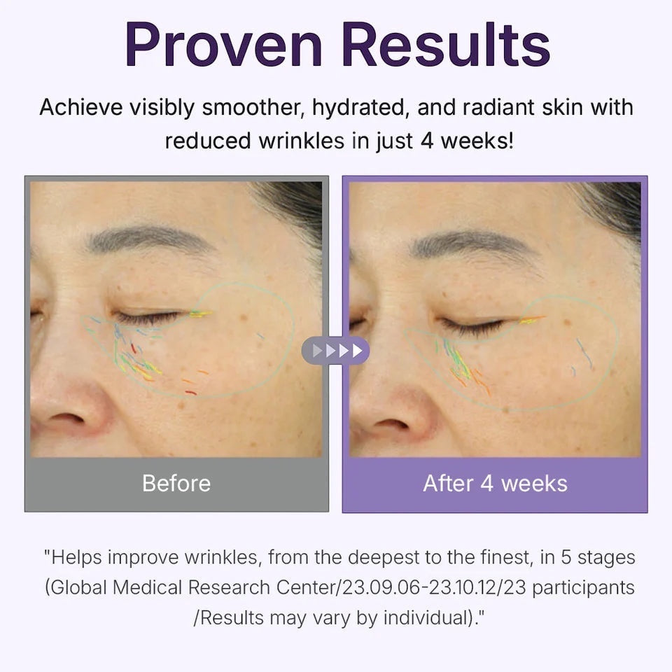 360º Shot PDRN Actieve Serum