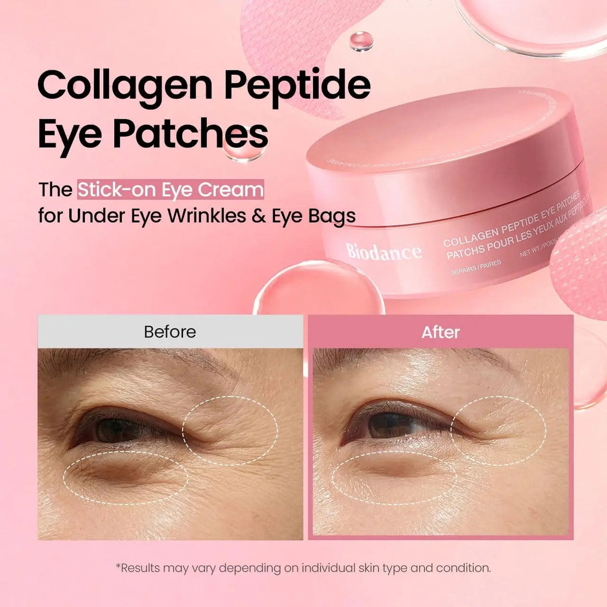 Collageen Peptide Oogpatches