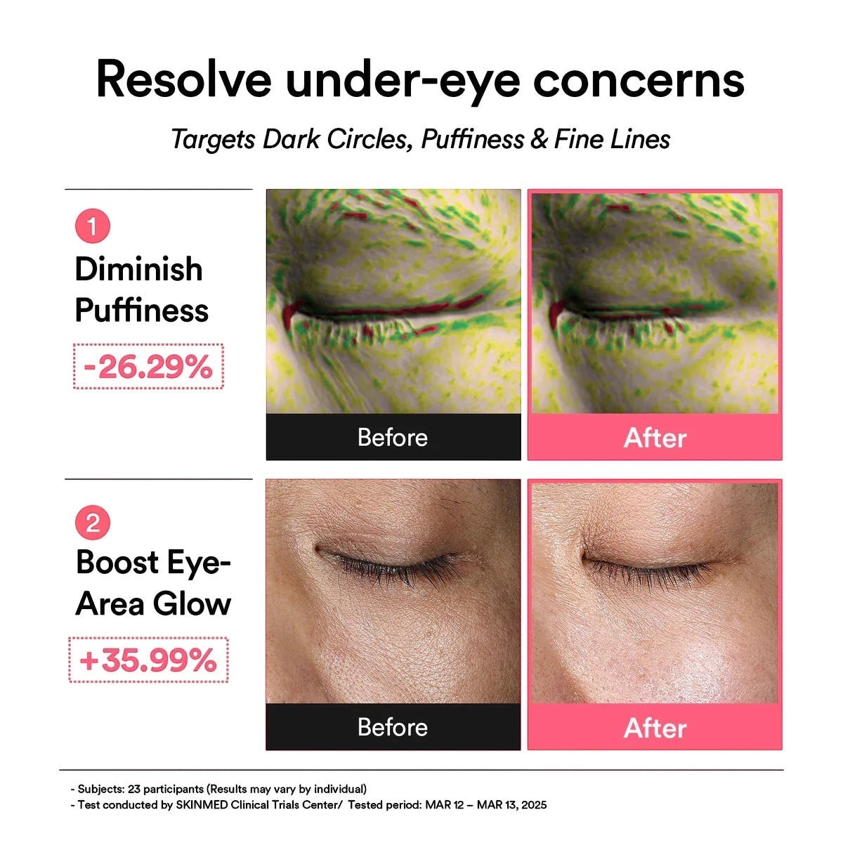 PDRN Retinale Oogmasker Glow Gel
