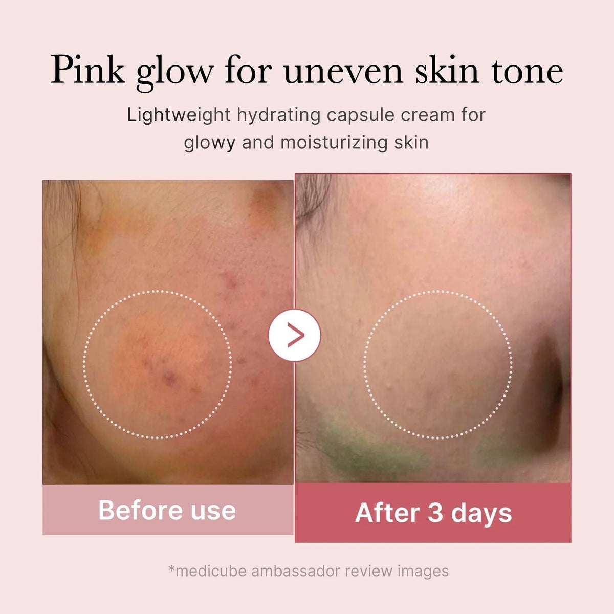 Crème en capsules de collagène rose PDRN