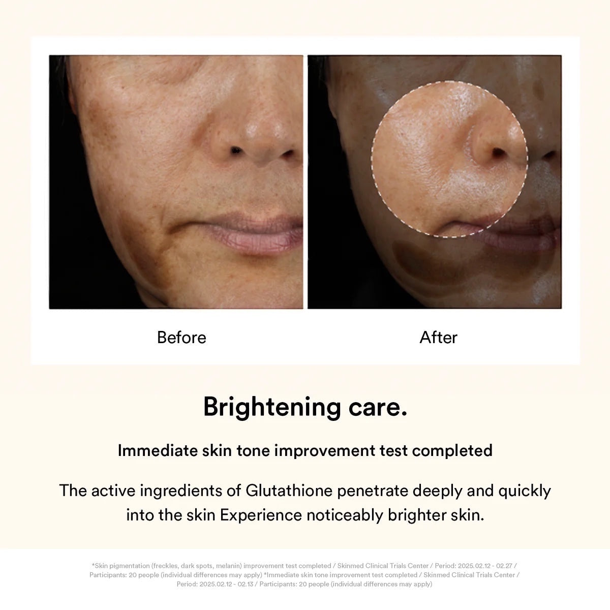 Donkere Vlek Collage Wikkelmasker Glutathione Film