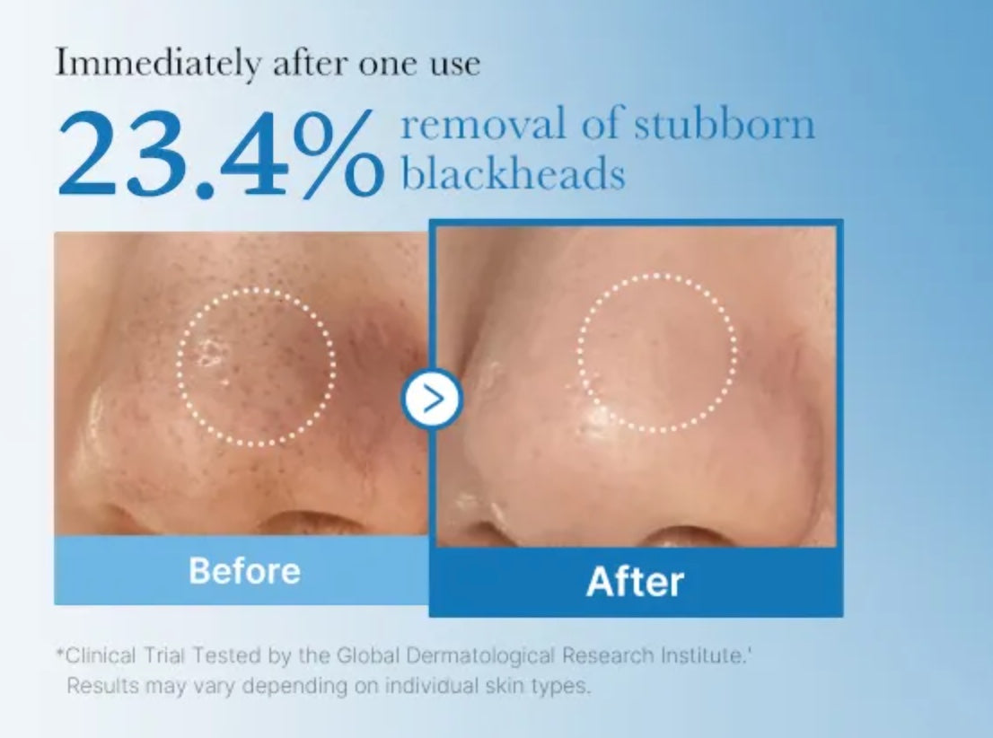 Zero Pore Blackhead Diepe Reinigingsolie