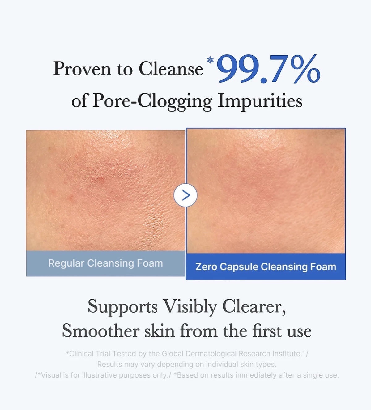 Zero Pore Capsule Reinigingsschuim